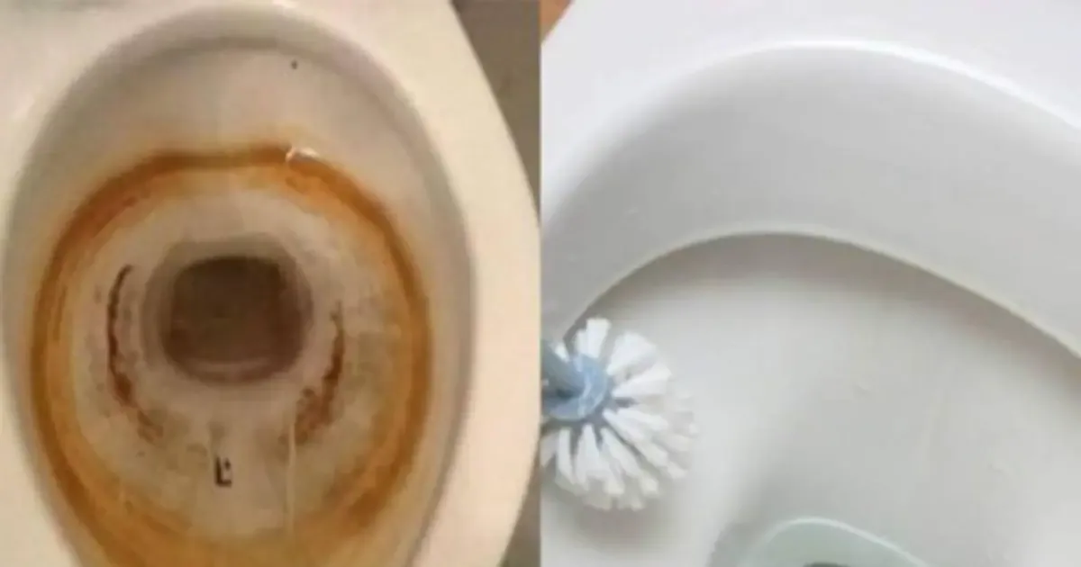 Eliminare il calcare dal WC: la miscela con 2 cucchiai di acido citrico pronta in 30 minuti