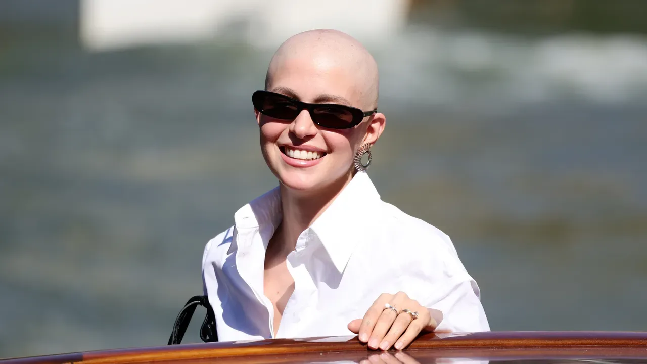 Natalia Paragoni a Venezia: il 7 settembre l'ultima chemioterapia per il linfoma di Hodgkin