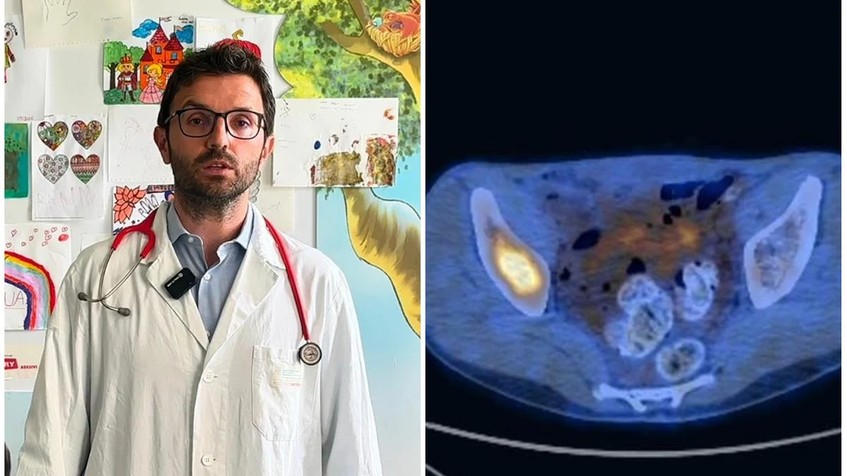 Rabdomiosarcoma: la Pet rileva le metastasi nel 98% dei casi ed evita la biopsia ai bambini