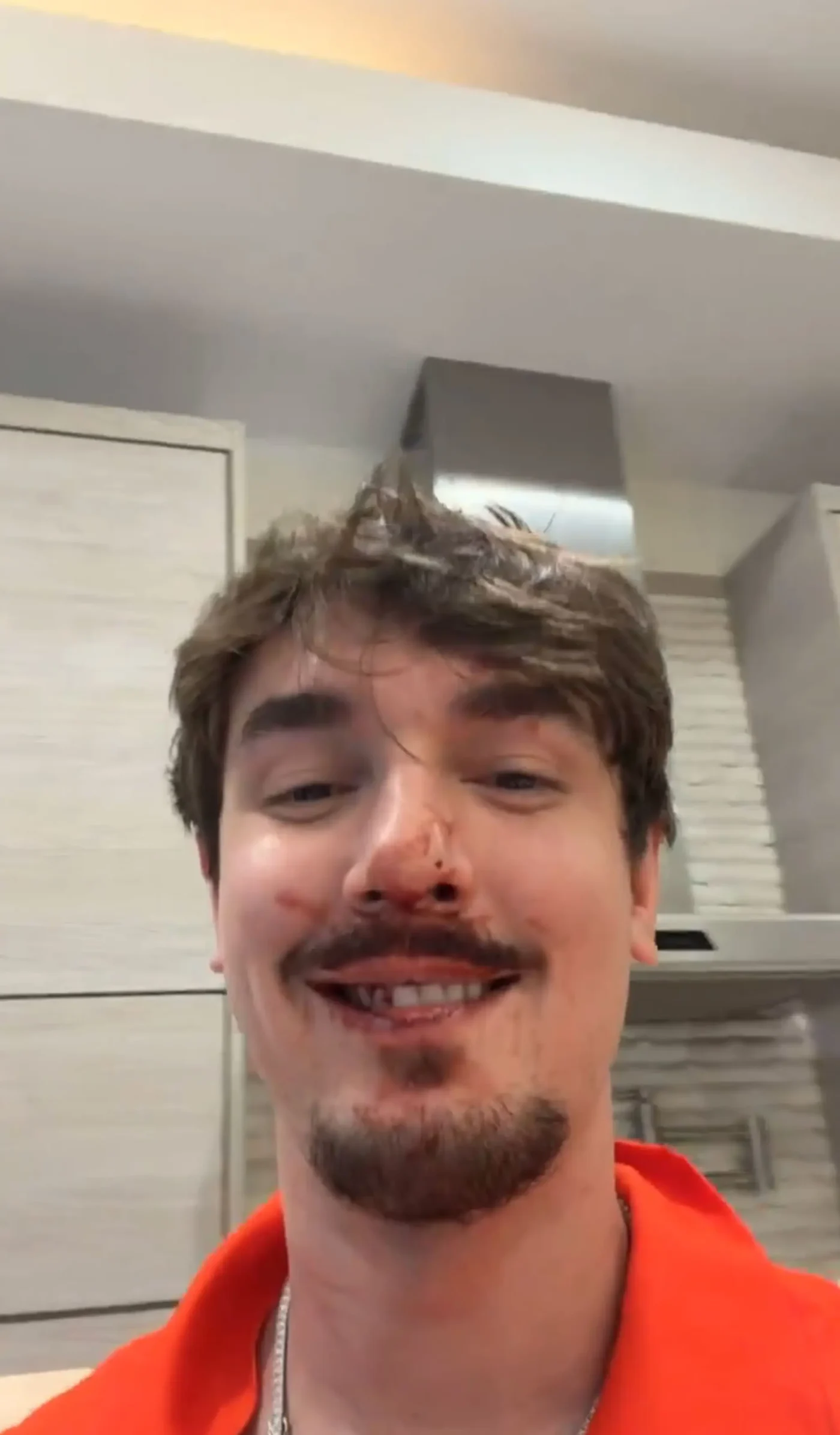 Bryce Hall smiling with blood on his face and missing a tooth.