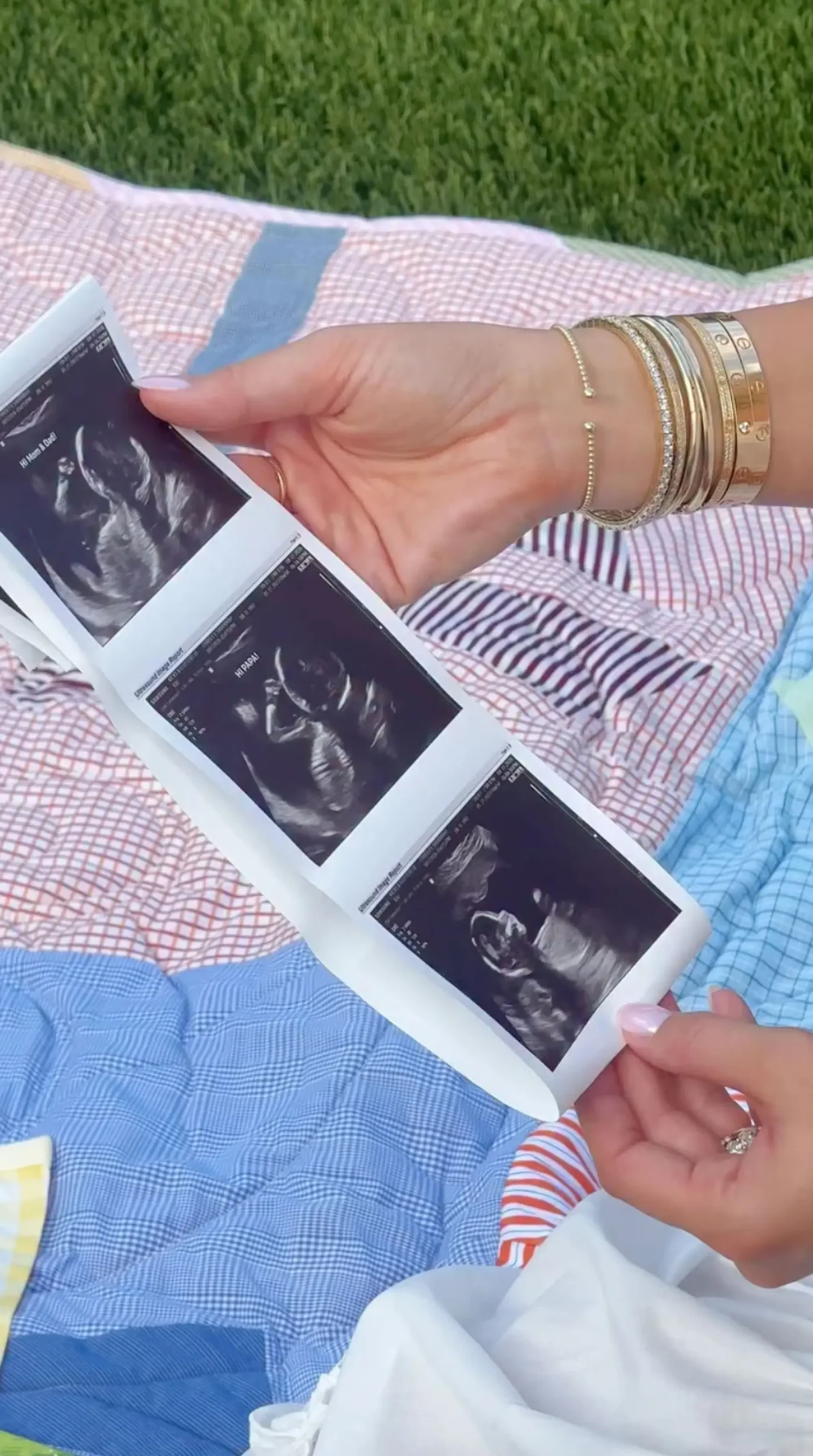 Hands holding a strip of three ultrasound images.