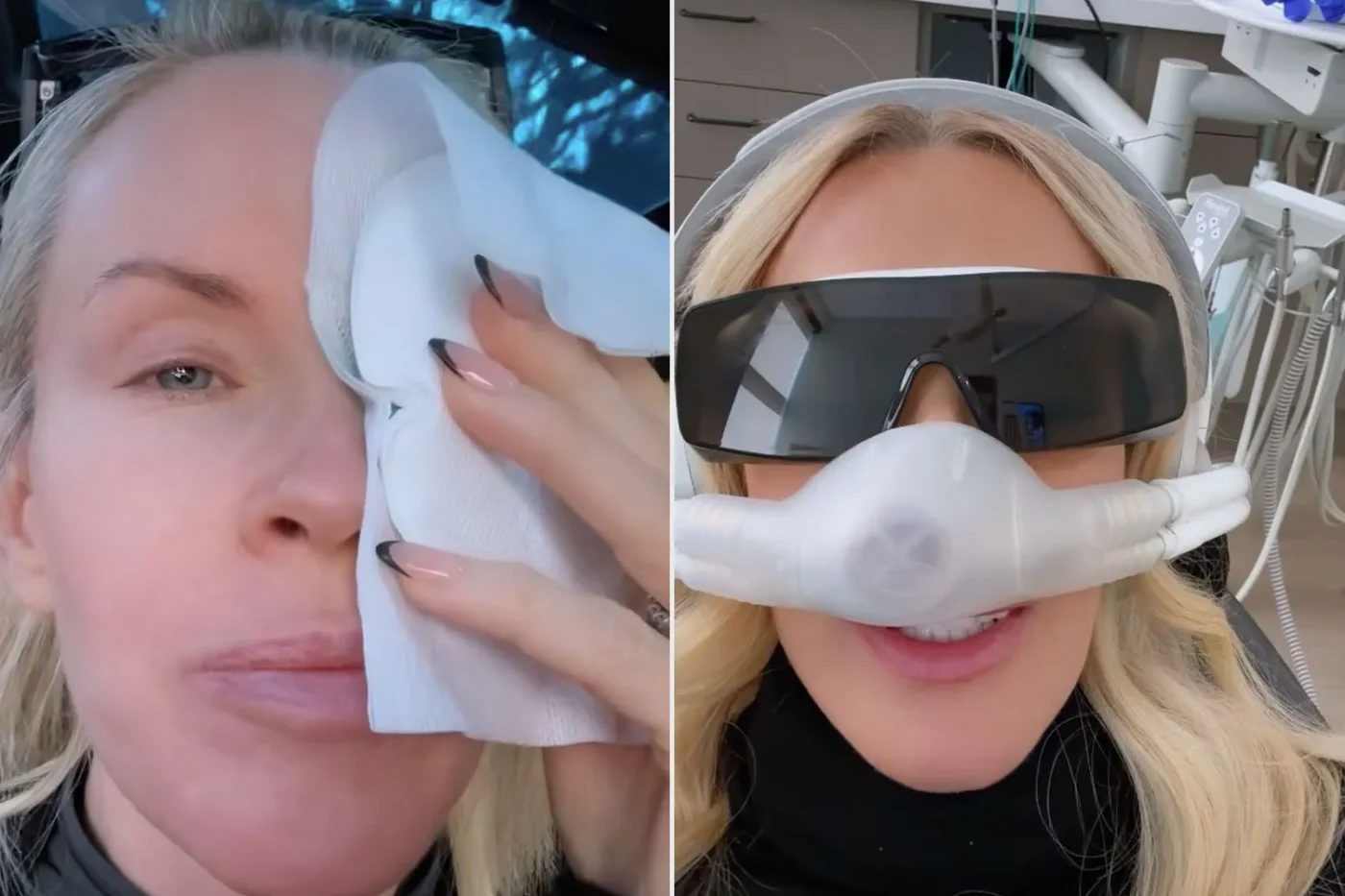Jenny McCarthy holding an icepack against her eye; Jenny McCarthy before surgery.