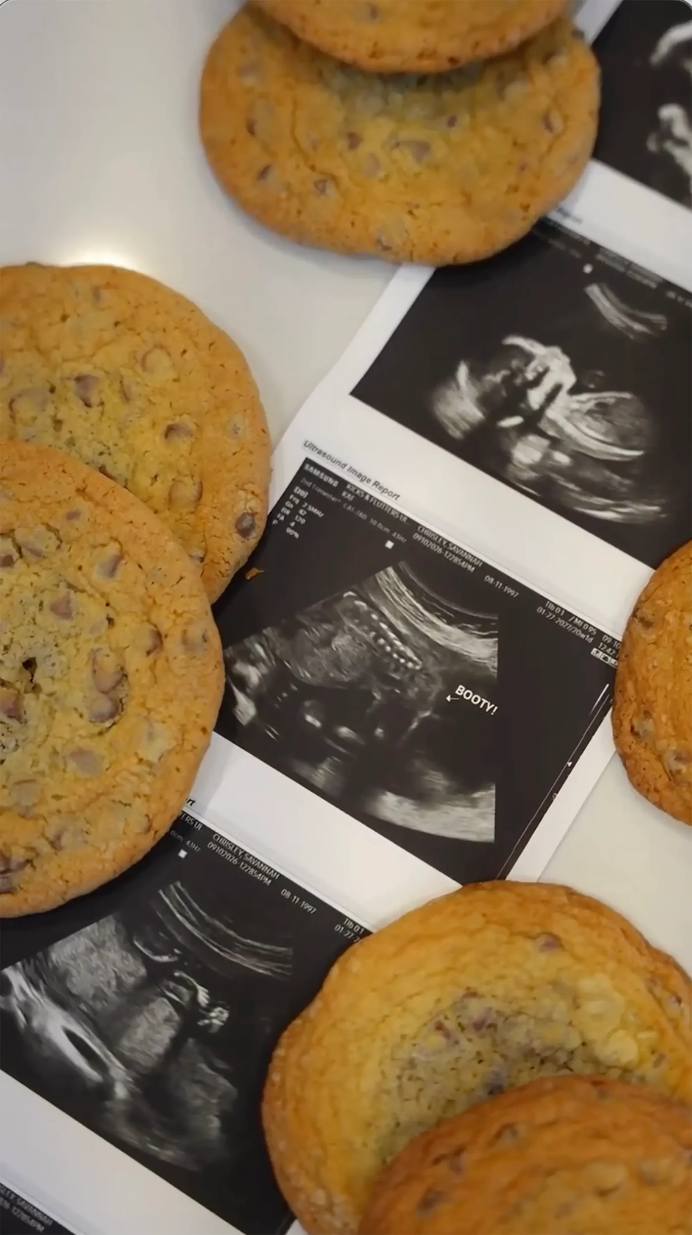 Ultrasound images surrounded by chocolate chip cookies.